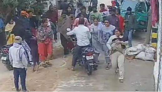 Delhi News: दादा की गोद से खींचकर पिटबुल ने बच्ची पर बोला हमला, दाहिने पैर की तीन जगह से टूटी हड्डी