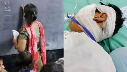महिला टीचर ने छात्र को फेंक कर मारा लोहे का स्केल, आंख कटी; दिल्ली AIIMS में कराई गई सर्जरी