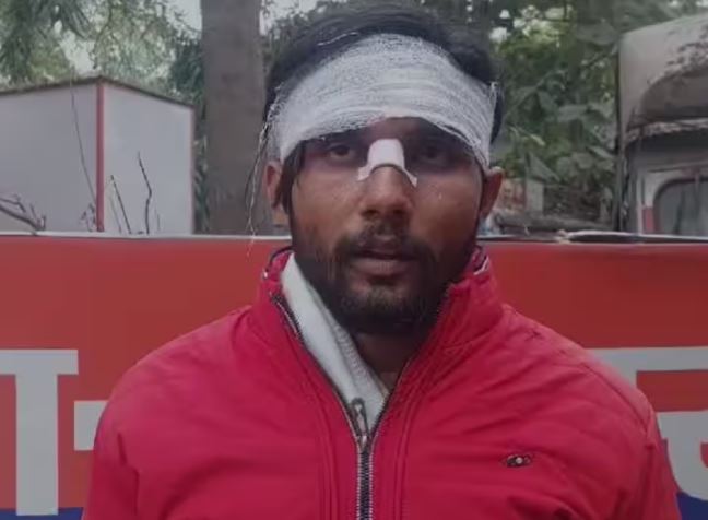 पीएम मोदी के मन की बात सुनने आए बीजेपी कार्यकर्ता की पिटाई, 9 लोगों पर मुकदमा दर्ज