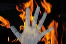 शादी से इनकार करने पर प्रेमिका को लगाई आग, एफआईआर दर्ज