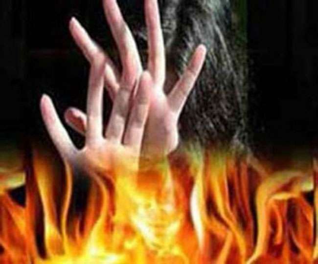 महिला ने पति पर लगाया पेट्रोल डालकर आग लगाने का आरोप, 40 फीसदी से अधिक आग में झुलसी महिला 
