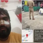 नोएडा में पैसों के विवाद में फायरिंग, बैटरी दुकान कर्मचारी की नाक छूकर निकली गोली