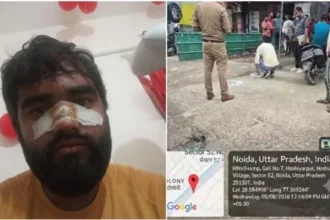 नोएडा में पैसों के विवाद में फायरिंग, बैटरी दुकान कर्मचारी की नाक छूकर निकली गोली