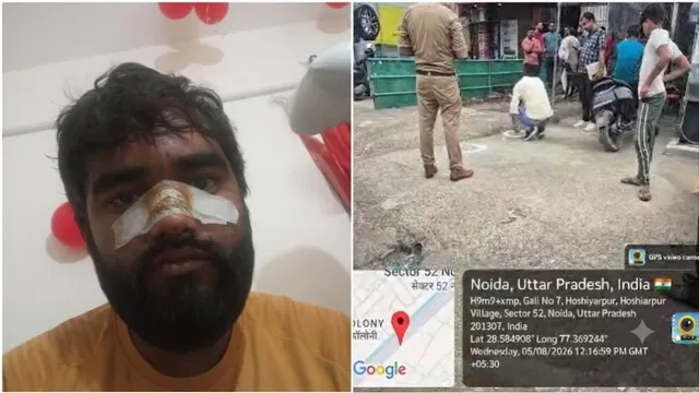 नोएडा में पैसों के विवाद में फायरिंग, बैटरी दुकान कर्मचारी की नाक छूकर निकली गोली
