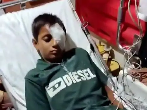 स्कूल में छात्र को डंडे से मारा, आंख फूटी: हालत गंभीर, दिल्ली एम्स में भर्ती; जेवर पुलिस कर रही जांच