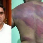 भाजपा कार्यकर्ता ने विधायक समेत कई पर लगाए बंधक बनाकर मारपीट के आरोप, पुलिस ने दर्ज किया केस