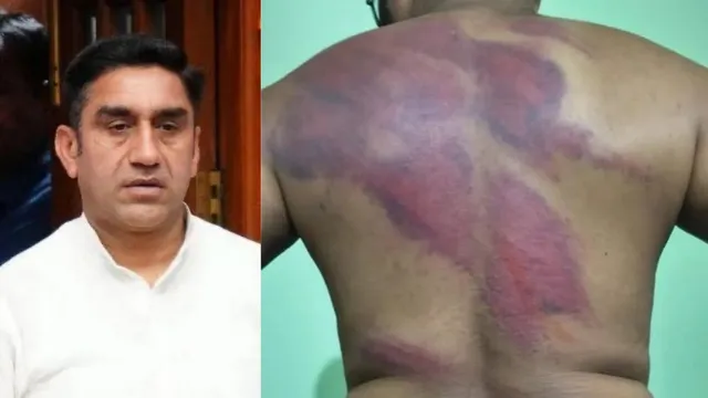 भाजपा कार्यकर्ता ने विधायक समेत कई पर लगाए बंधक बनाकर मारपीट के आरोप, पुलिस ने दर्ज किया केस