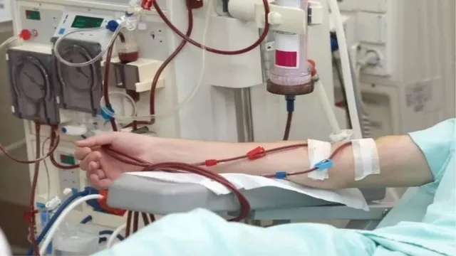 दिल्ली वालों के लिए बड़ी राहत: MCD के 5 और अस्पतालों में मिलेगी सस्ती डायलिसिस सुविधा, हर महीने 3600 मरीजों को फायदा