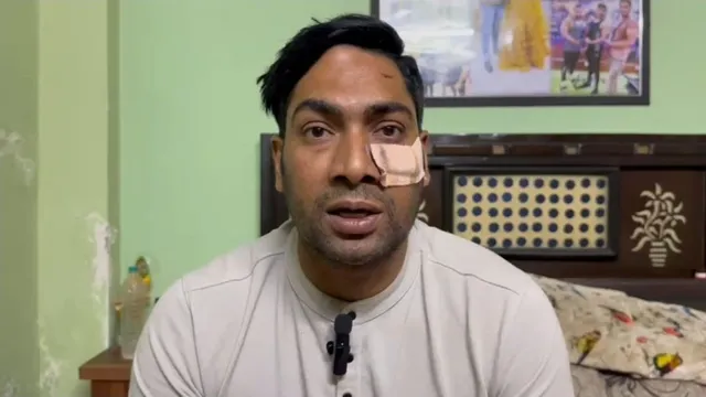 दिल्ली में खाकी पर हमला: हेड कॉन्स्टेबल को दौड़ा-दौड़ाकर पीटा, सोने की चेन और मोबाइल लूटकर फरार हुए बदमाश